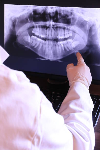 Best Emergency Treatment for Toothache in Bent, NE